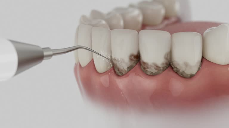 Reliable Teeth Cleaning And Checkup contractor in Guernsey County County, OH by Dentist Open Now